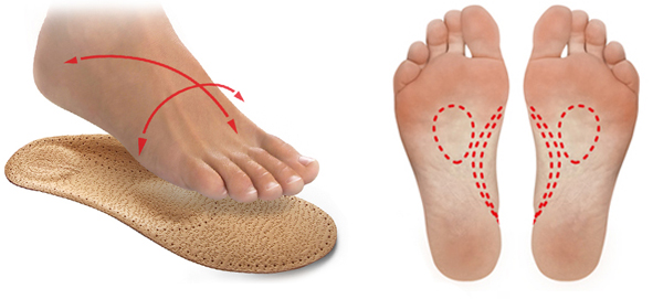 Podpera pozdĺžnej a priečnej klenby